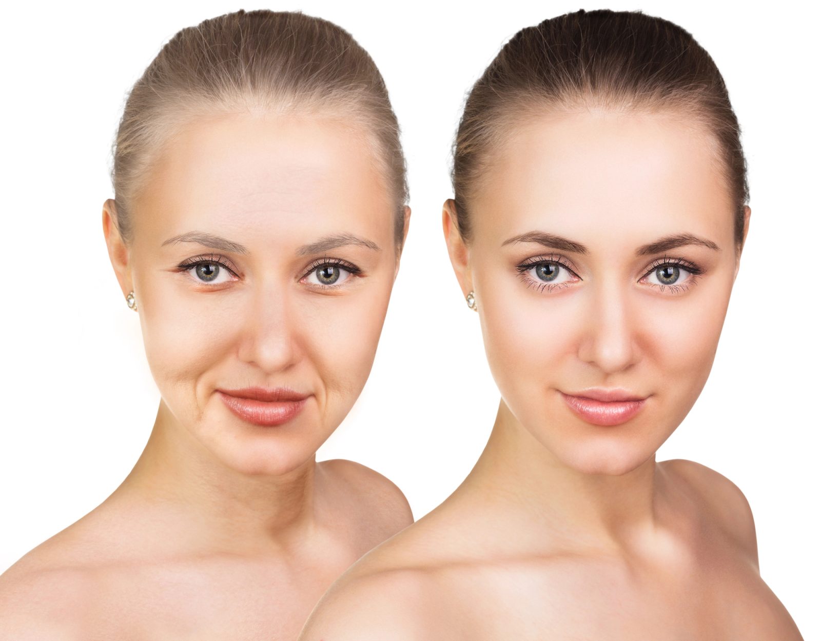 Korekcija vek pri moji mami